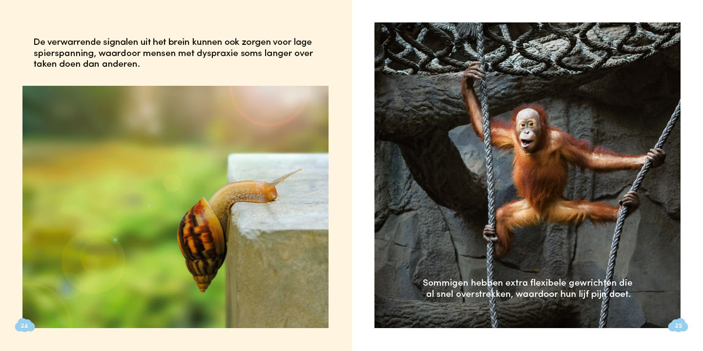 Alles over dyspraxie - Afbeelding 3